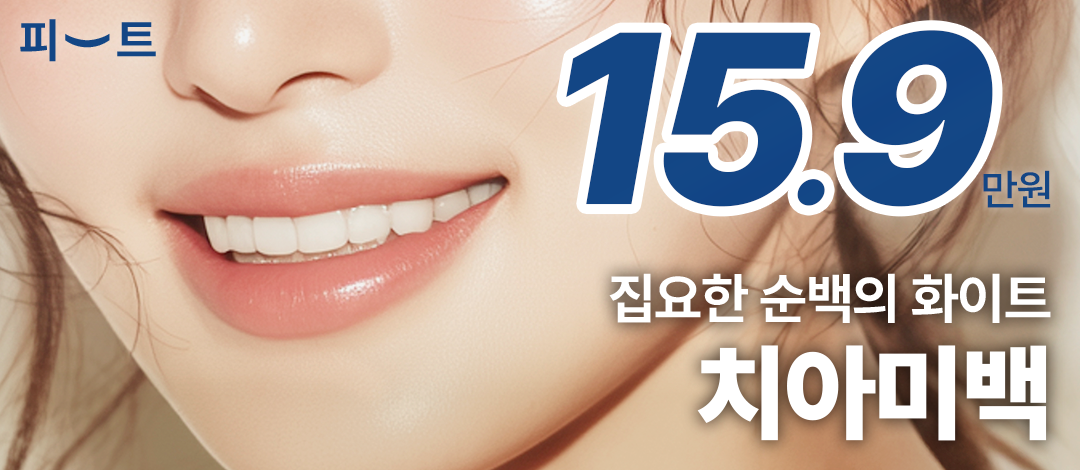 치아미백 3회 원데이치과치아미백 패키지