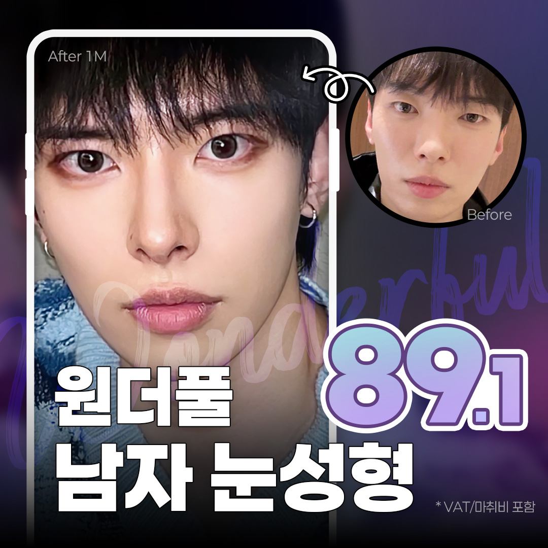 원더풀_남자눈성형