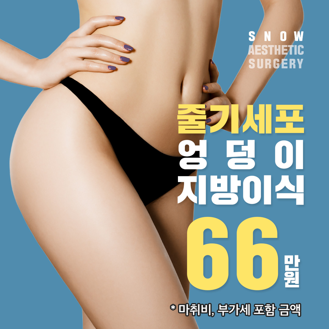 줄기세포 힙업 엉덩이지방이식