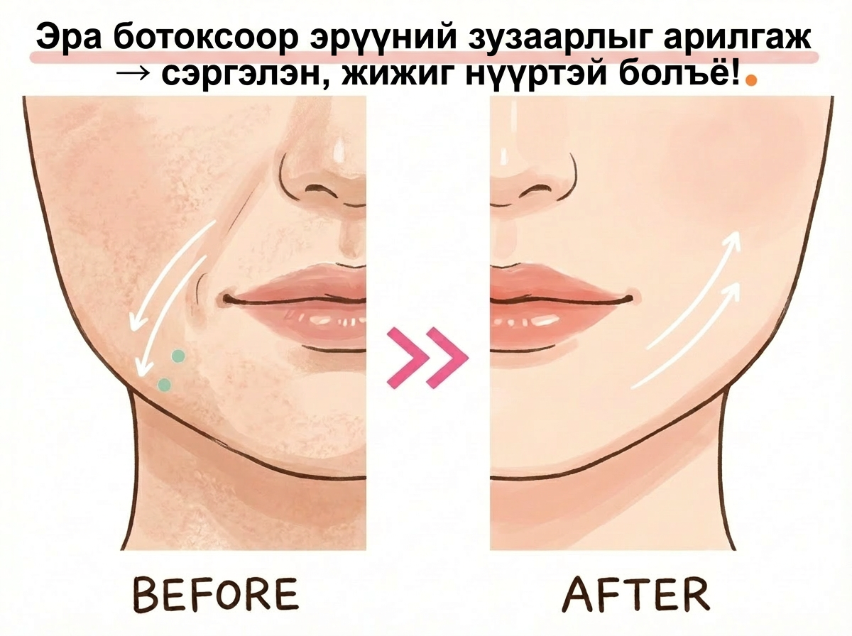 Ботокс тарилгын давтамж, үргэлжлэх хугацаа