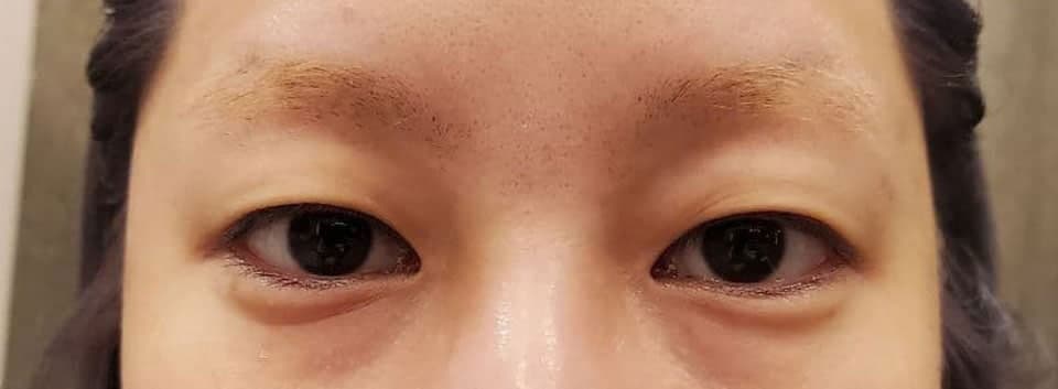 자연유착 한지 이제 한달 조금 지났는데요~