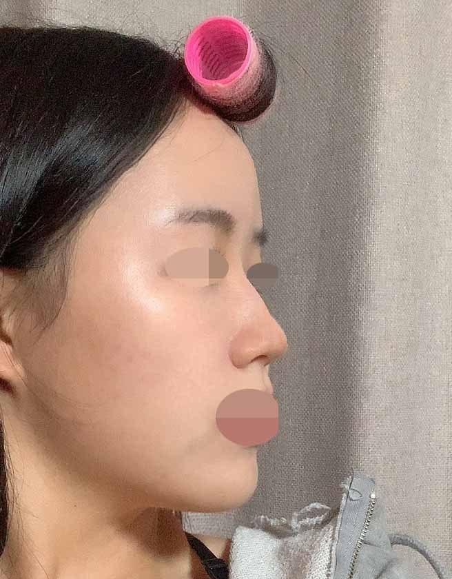 너무 만족합니당~후기남겨드립니다.