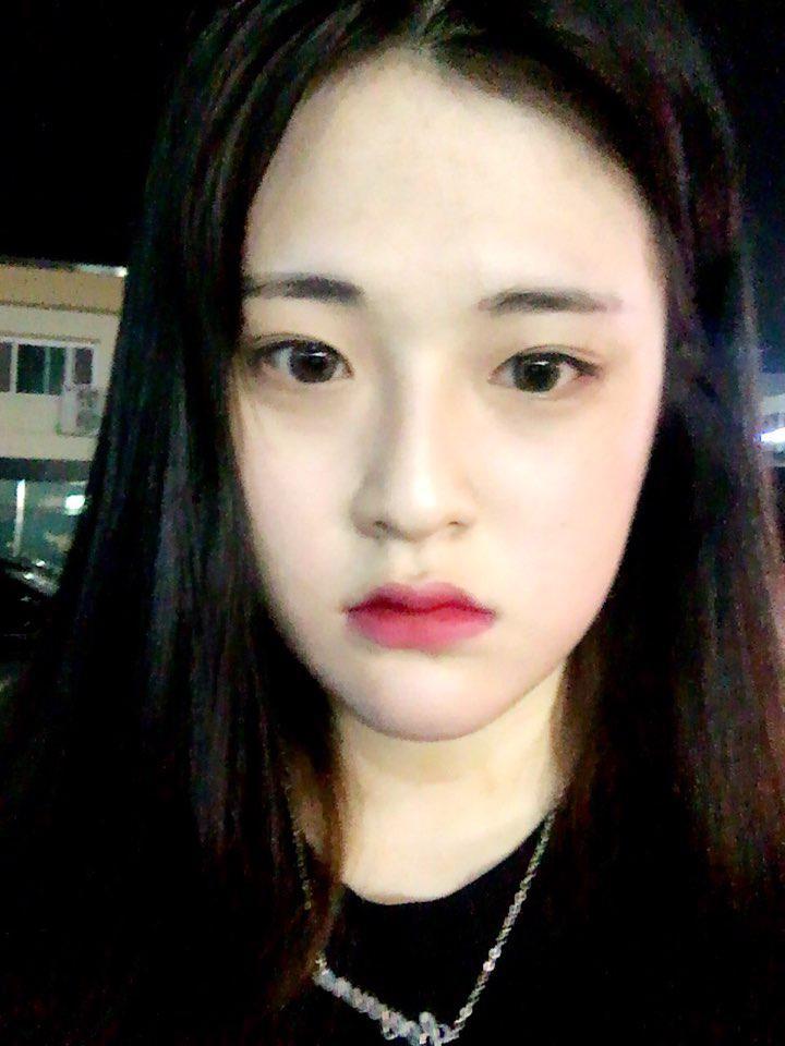 너무 행복해요~~~수술한지 6개월 됐는데 이젠 정말 정말 수술한거 모르는 사람이 대다수 일 정도 입니다 ~