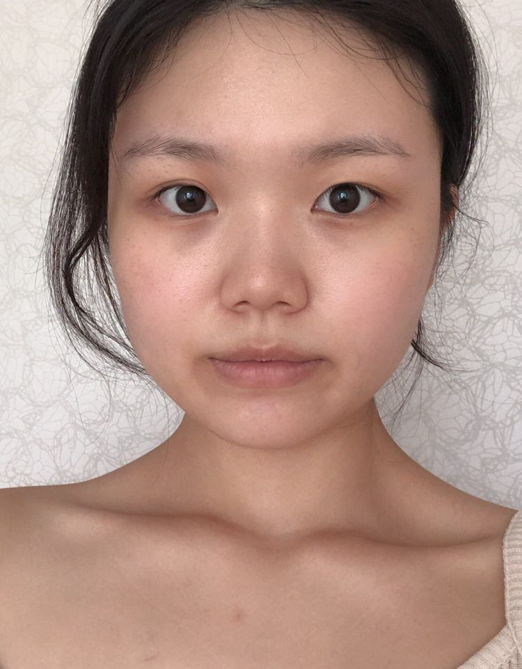 원장님 감사해여 후기남겨드립니다