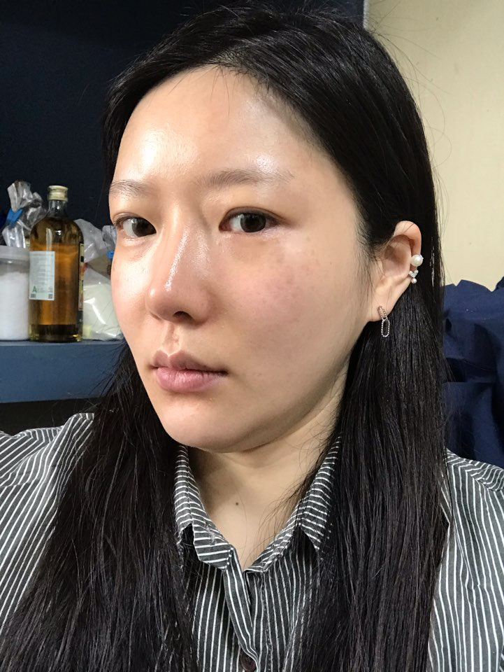 턱밑 지흡만 하려다가 엘꿈이랑 민트실이랑 섞어서 했는데 확실히 만족 합니다! 후기 남겨드립니다