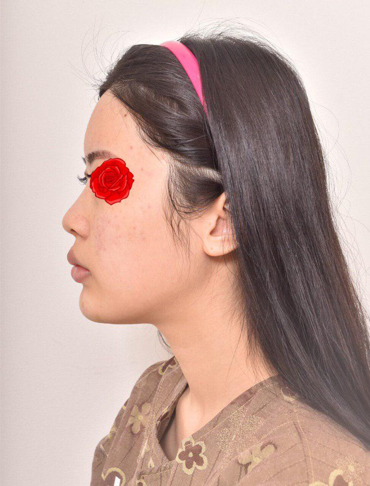 만족스럽습니당!!임영민 원장님 감사합니다앗