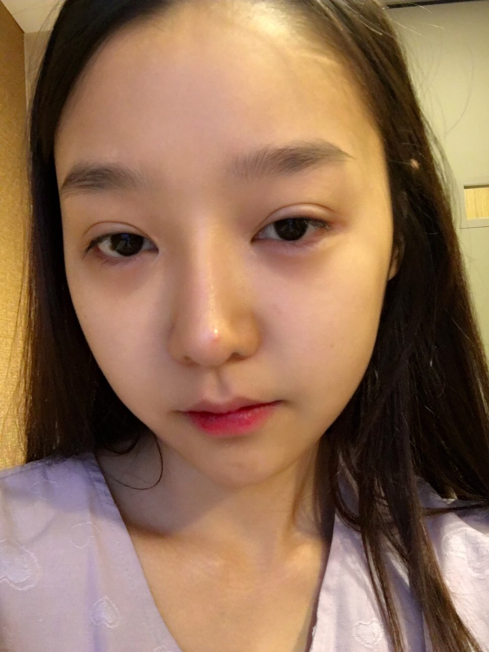 재수술 고민하지말고 베리굿에서 하세요~