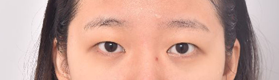 쌍수하고 쌍테버렸습니다.