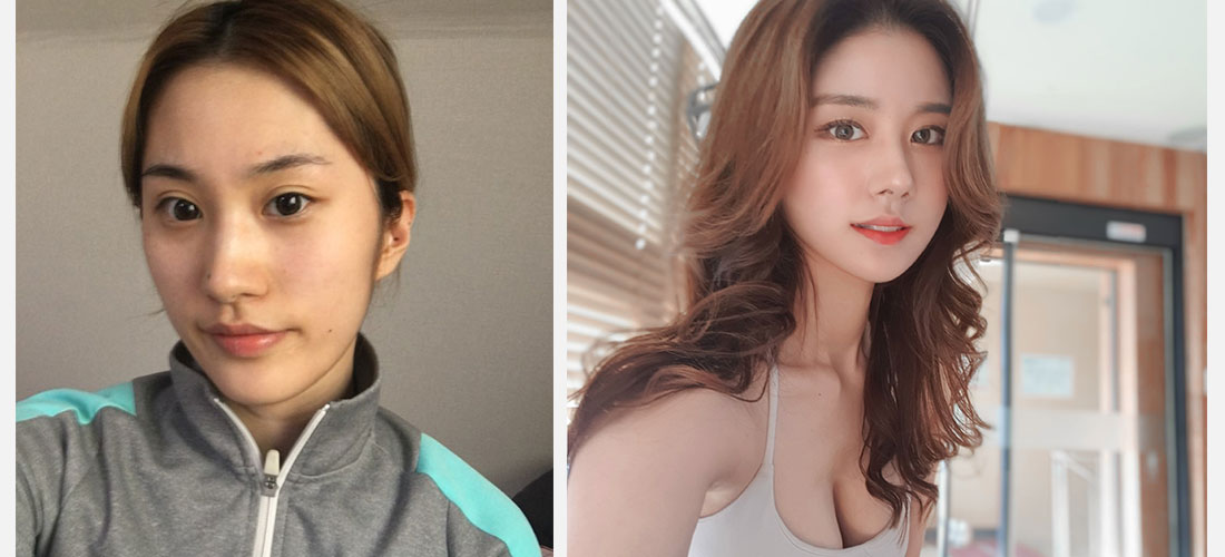 Нүд, хамар, нүүрний хэлбэр, бүтэн нүүрний өөх шилжүүлэн суулгах, уруулын филлер