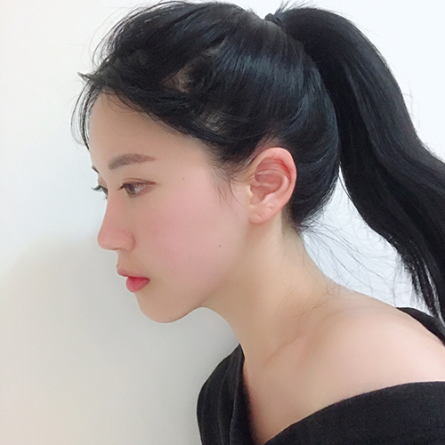 Tái phẫu thuật mắt hai mí, mở góc mắt dưới, mở góc mắt ngoài, sống mũi, đầu mũi, gồ mũi, cắt xương, gọt mặt 4 loại