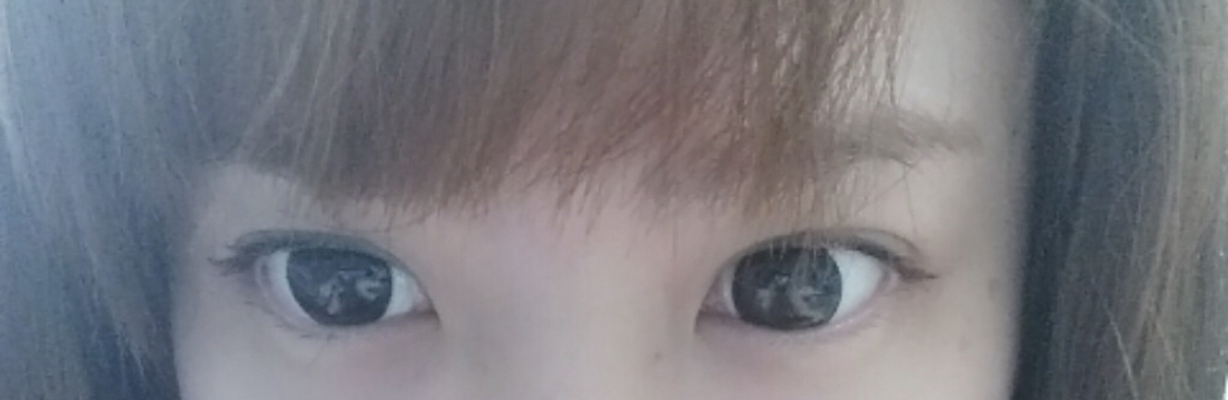 [눈] 무비스타7 - 뒤트임, 밑트임