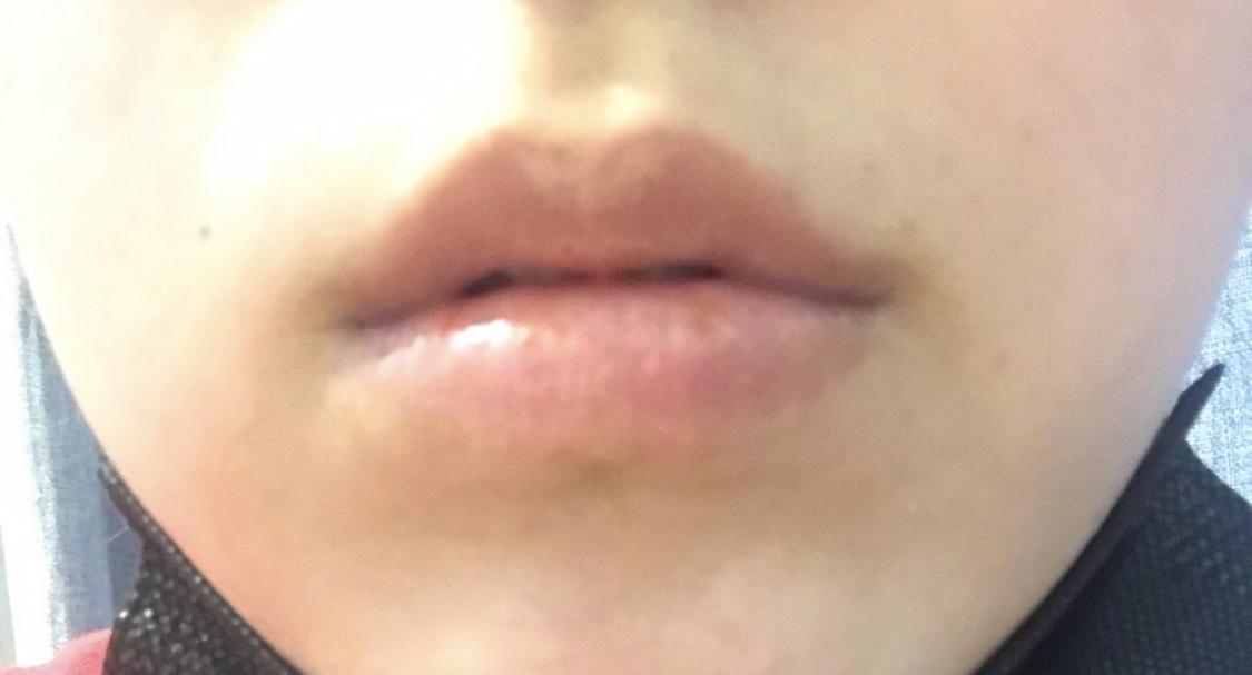 [쁘띠] 뭉치짜으릉 - 필러