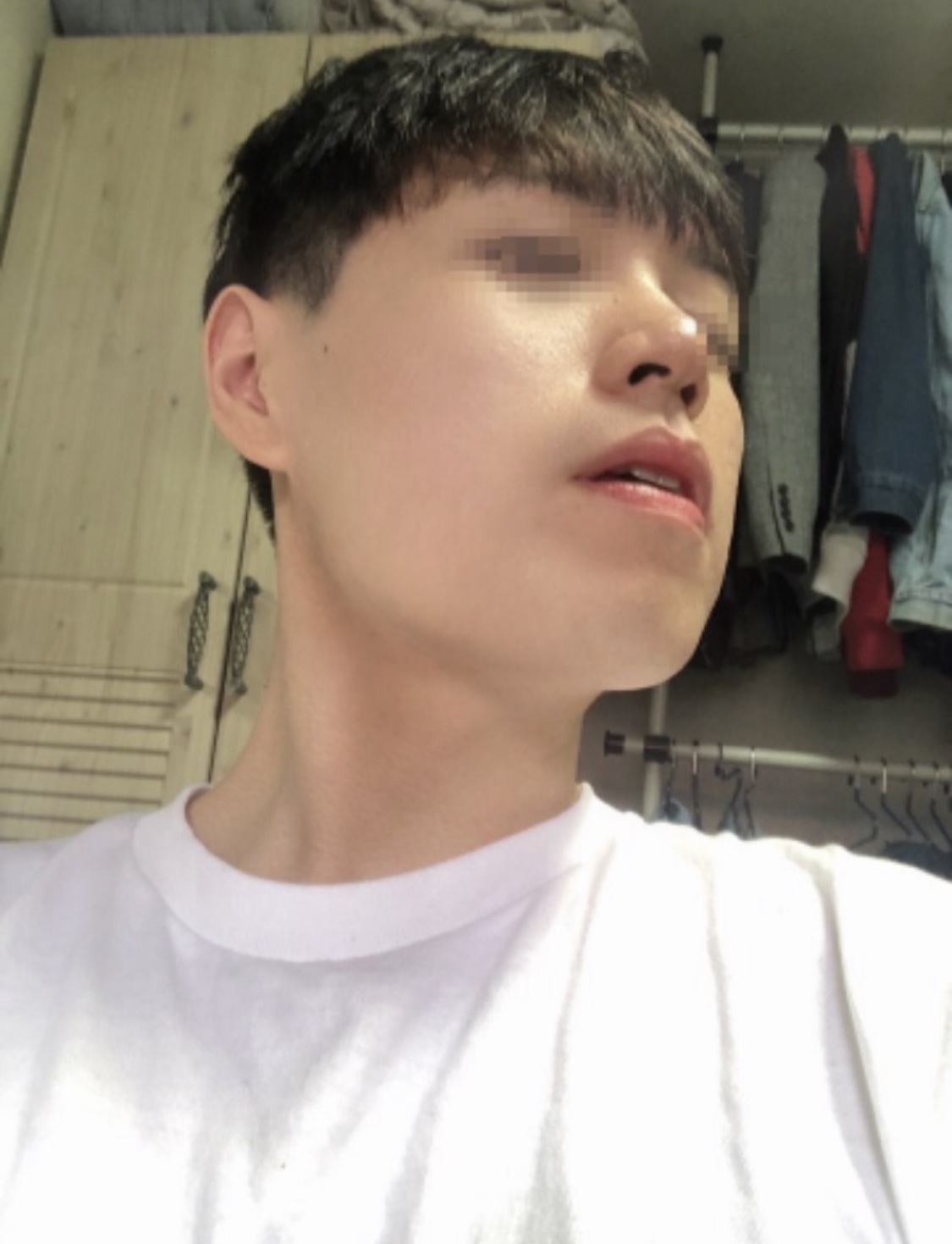 [안면윤곽] 코즈802 - 사각턱,턱끝,콧대