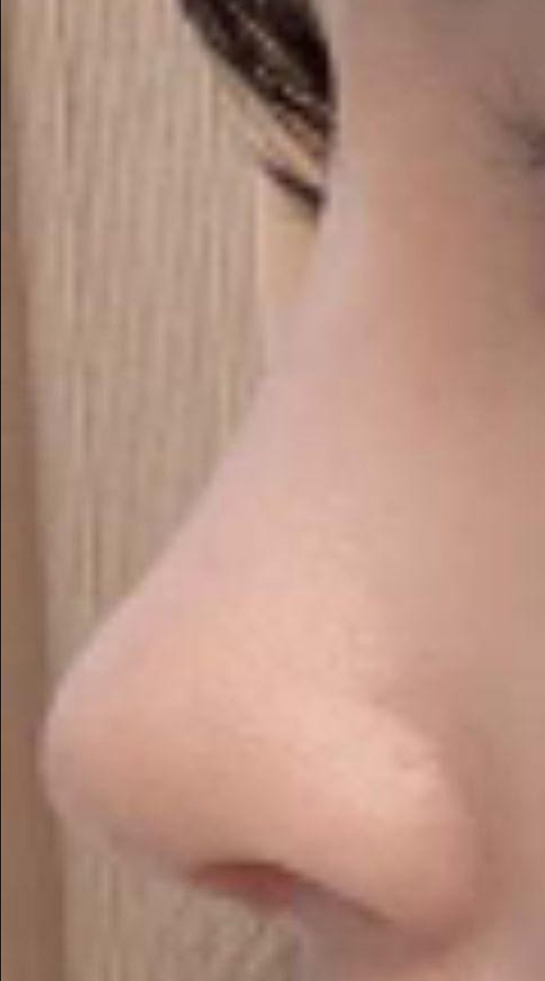 [Mũi] Yabanchu - Mũi