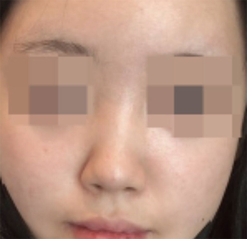 [Mũi] Anging Ungongang - Mũi