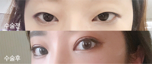 [Нүд] Eunmikami - Нүд