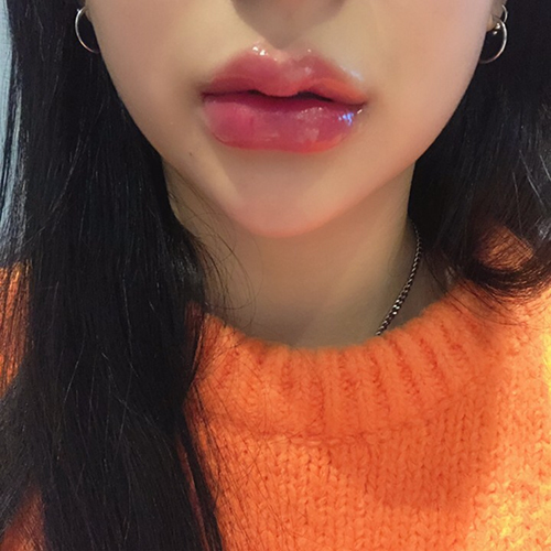 [Жижиг] naaa_ - Филлер