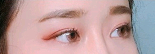 [Нүд] Лууван - Нүд