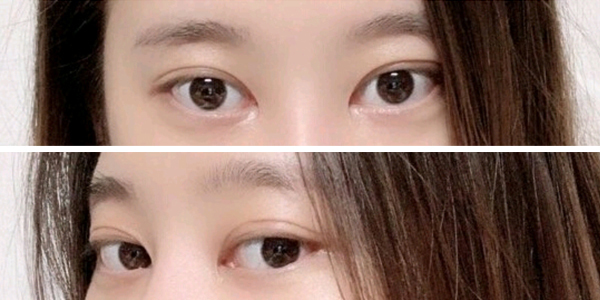 [Нүд] Ду Чисс - Нүд