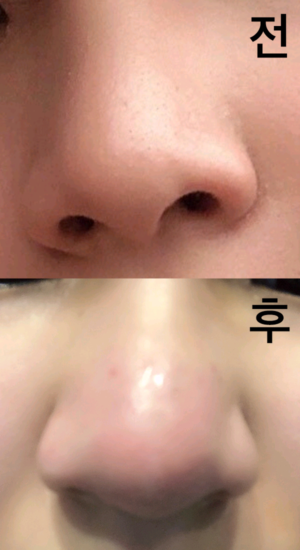 [Жижиг] Уруул - Хамрын баримал тариа