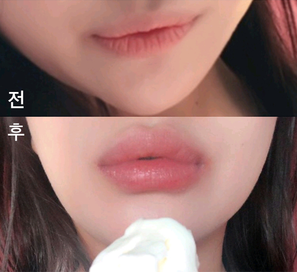 [Жижиг] bkbkbk - Уруулын филлер