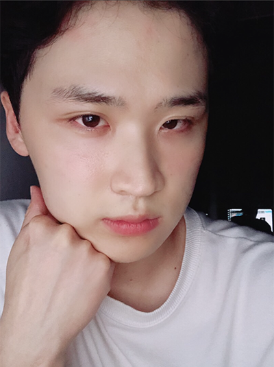 [Эрэгтэй] Гөлөг - Нүд