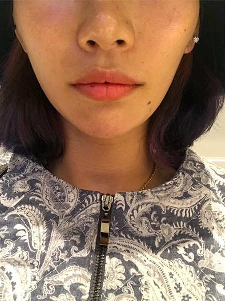 [Бяцхан] Нүүр будалт хийдэг муур - Уруулын филлер, ботокс