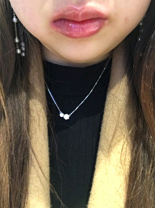 [Жижиг] Бэгопхүжажа - Уруулын филлер, ботокс