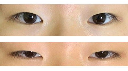 [Нүд] Бяцхан - Нүд