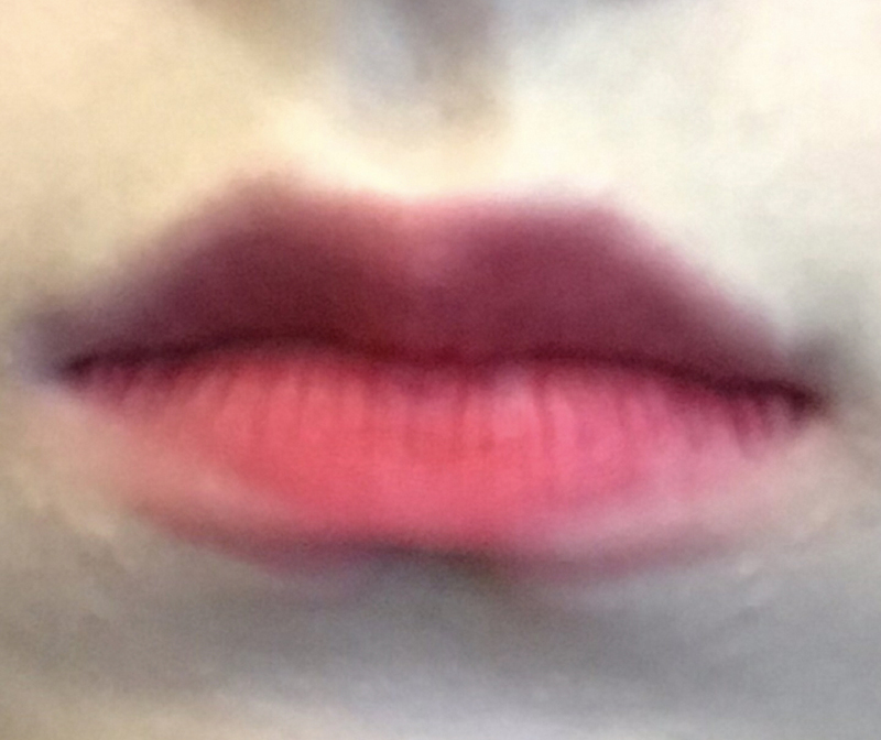 [Жижиг] Давхар зовхины мэс засал амжилттай боллоо - Уруулын филлер