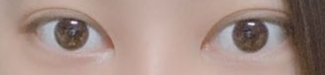 [Нүд] Буккубуккубямбям1 - Давхар зовхи, хойд зүсэлт, доод зүсэлт