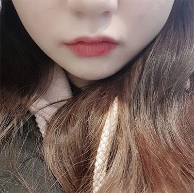 [Бяцхан] Жанъяаа - Шринк, Ботокс