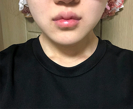 [Арьс] Пюнггюнг - Шринк