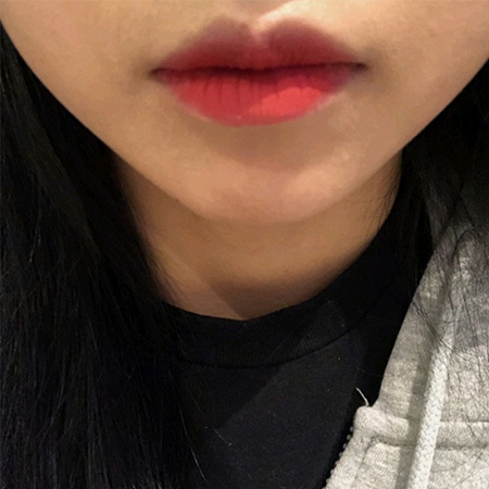 [Бяцхан] И1ппюдю - Уруулын булангийн филлер, ботокс