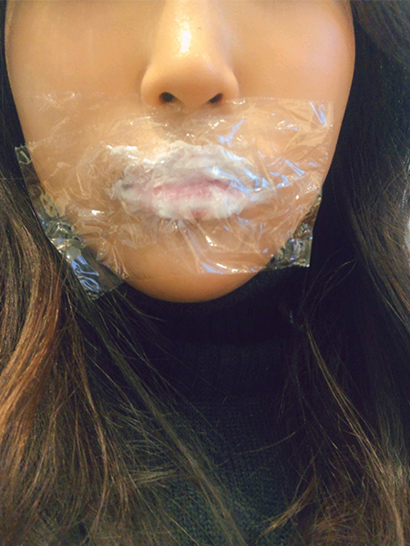 [Жижиг] hyb - Уруулын филлер, ботокс