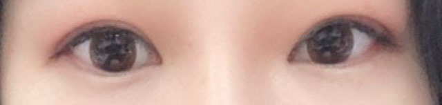 [Нүд] Соссоту - Нүд