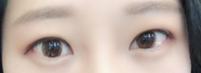 [Нүд] Соссоту - Нүд