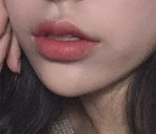 [Жижиг] Юу гэх вэ дээ - Уруулын филлер, ботокс