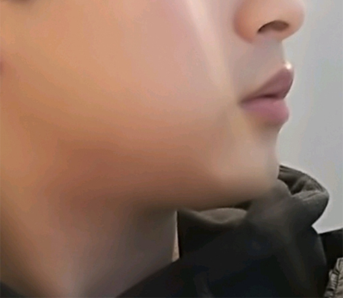 [Арьс] Кярюк-рюк - Шуринк, Контур Токс