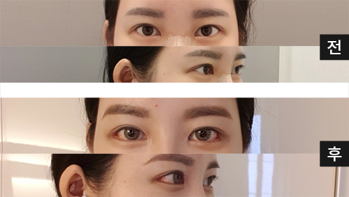 [Нүд] Никкюи - Нүд