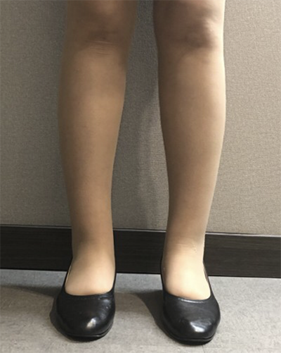 [Өөх соруулах] Од шиг нис - Шилбэ