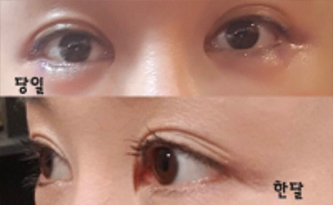 [Нүд] Бэл Бэл Бэл18 - Нүд