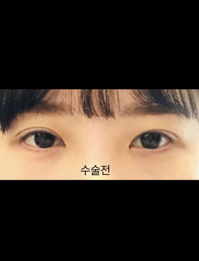 [Нүд] Жухи95 - Нүд