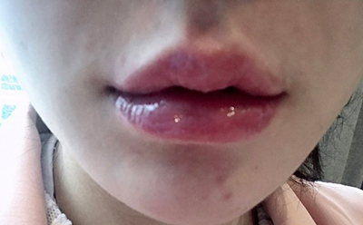 [Бяцхан] Эрт - Уруул