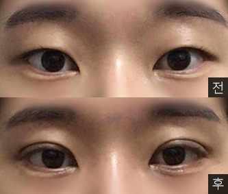 [Нүд] Үүл шиг тунгалаг - Нүд