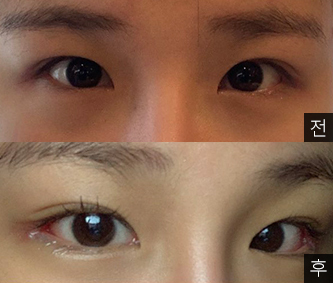 [Нүд] Дал И Жан эгч - Нүд