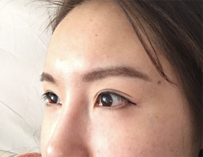 [Нүд] Лай Лай Лай - Нүд