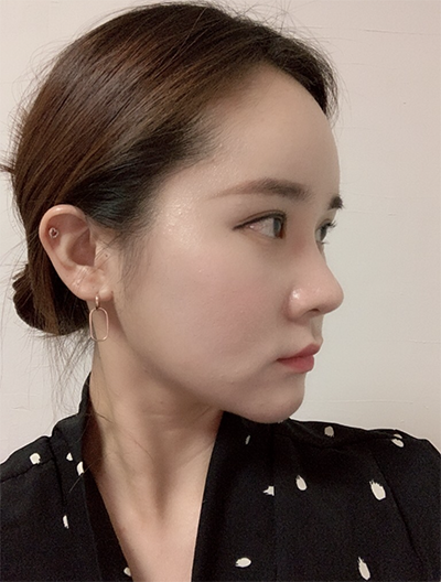 [Бяцхан] Кияхо1115 - Лифтинг