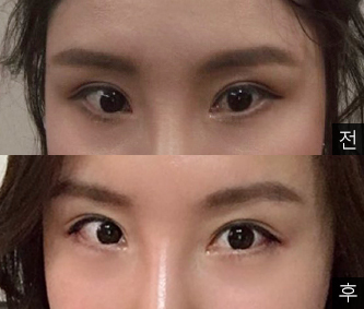 [Нүд] Лай Лай Лай - Нүд