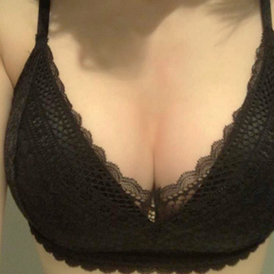 [豊胸] 堂々としたバスト